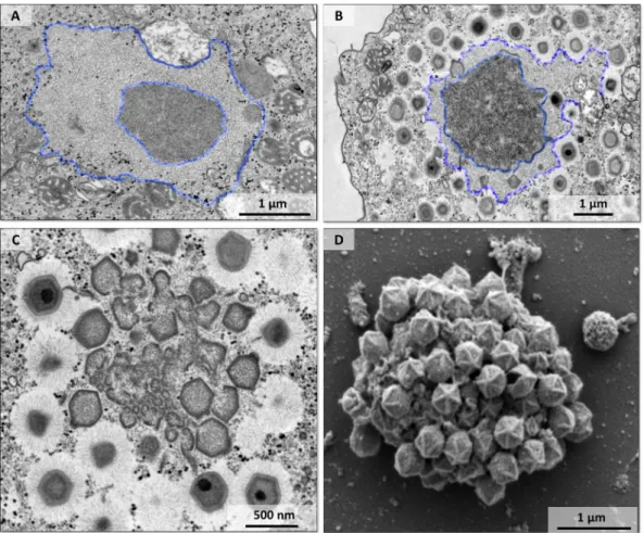 FIG 4 An area of ﬁbril acquisition is present in the periphery of the viral factory. (A to C) Transmission electron microscopy images of the viral factory of mimivirus with a less-electron-dense area surrounding the periphery of the factory that decreased 