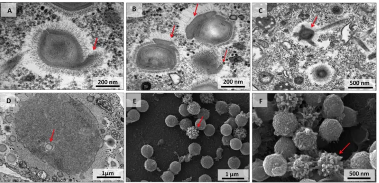 FIG 6 Defective particles in the mimivirus replication cycle in the absence of virophages