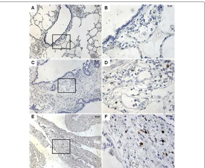 Figure 6 Immunohistochemistry with Ki-67. From left to right, original magnification x 10 (A, C, E), x 40 (B, D, F)