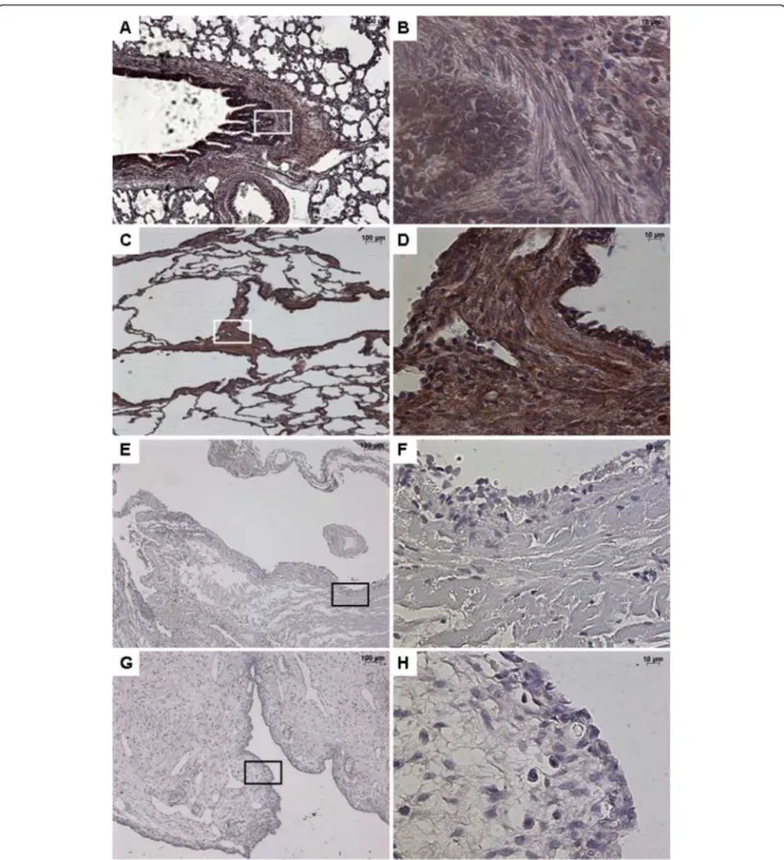 Figure 1 Immunostaining with FGF10. From left to right, original magnification x 5 (A, C, E, G), x 40 (B, D, F, H)