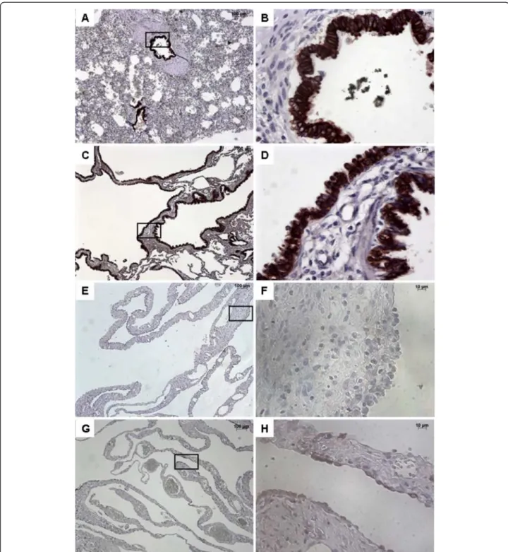 Figure 2 Immunostaining with FGFR2b. From left to right, original magnification x 5 (A, C, E, G), x 40 (B, D, F, H)