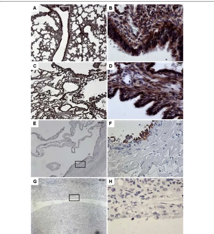 Figure 4 Immunohistochemistry with SHH. From left to right, original magnification x 5 (A, C, E, G), x 40 (B, D, F, H)