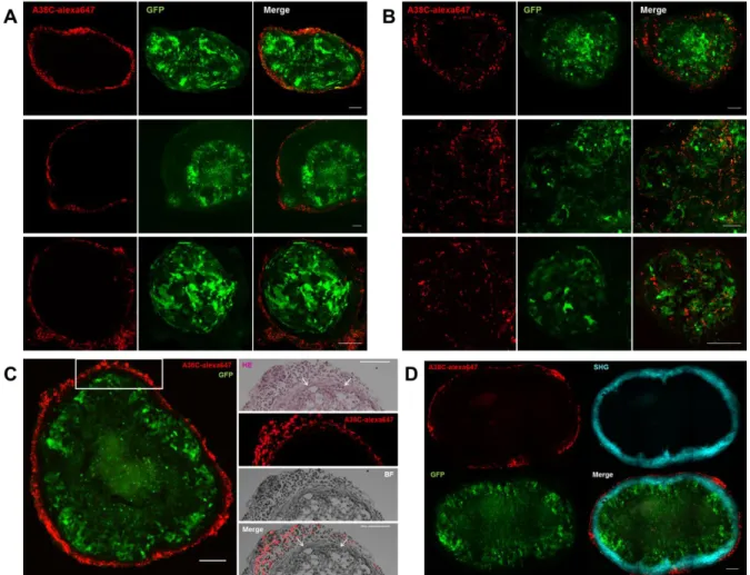 Figure 7: Characterization of A38C interaction with nodules in vivo. Confocal imaging of peritoneal nodules’ 