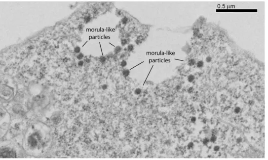 Figure 9. Electron microscopy of EP-39-treated, Pr55Gag-expressing cells. Samples of Sf9 cells coinfected with AcMNPV-Pr55Gag and AcMNPV-LucVpr at equal MOI, were treated at 24 h pi with 10 mg/ml of EP-39 inhibitor for 24 h, harvested at 48 h pi, and proce