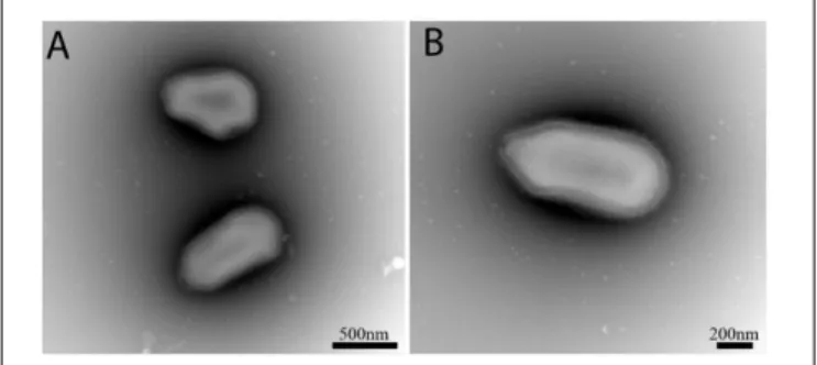FIGURE 1 | Negative staining obtained from the co-culture supernatant of well LCC2. Scale bars are indicated on each panel