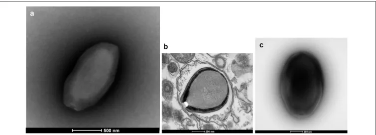 FIGURE 1 | Electron microscopy pictures of pandoravirus isolates by negative staining (a,c) or after inclusion (b)