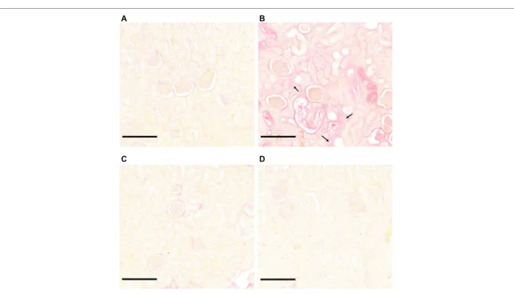 FIGURE 4  |  L. interrogans-induced interstitial fibrosis. Microscopic observations of kidney sections stained with Sirius Red obtained from control animals (A) and animals  infected with L