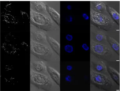 Figure 6. Confocal images showing the uptake and the cellular distribution of long AgNWs in human primary keratinocytes cells after 24 h of exposure to 1.5 µg/mL of L-AgNW