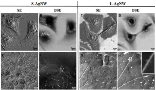 Figure 4. SEM images showing the uptake, the cellular distribution and changes of short (Left panel: