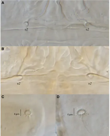 Fig. 3 Morphological differences between Brevipalpus obovatus Donnadieu and B. chilensis Baker