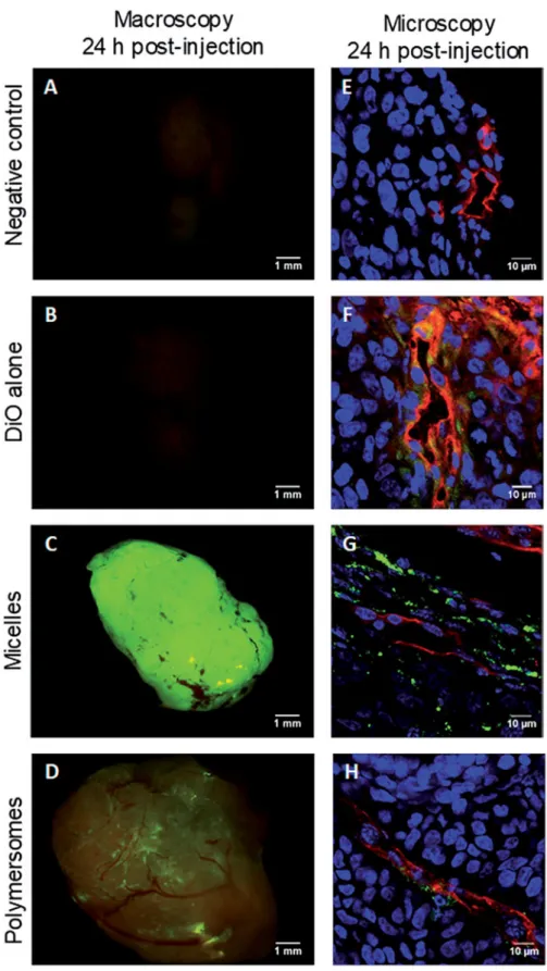 Figure 5. Macroscopic and microscopic (cryosection) fluorescent pictures of explanted HCT-116 tumors 24 h after retro-orbital injection in mice of 100 m L of PBS (A,E), DiO alone (B,F), micelles charged with 20% mol DiO (C,G), or polymersomes charged with 