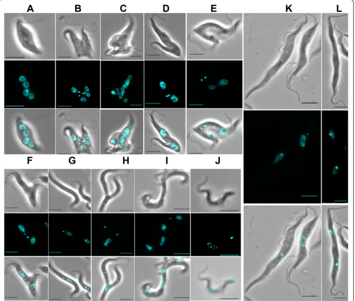 Figure 3 Pleiotropic morphological changes associated with growth defects following RNAi knockdown in T