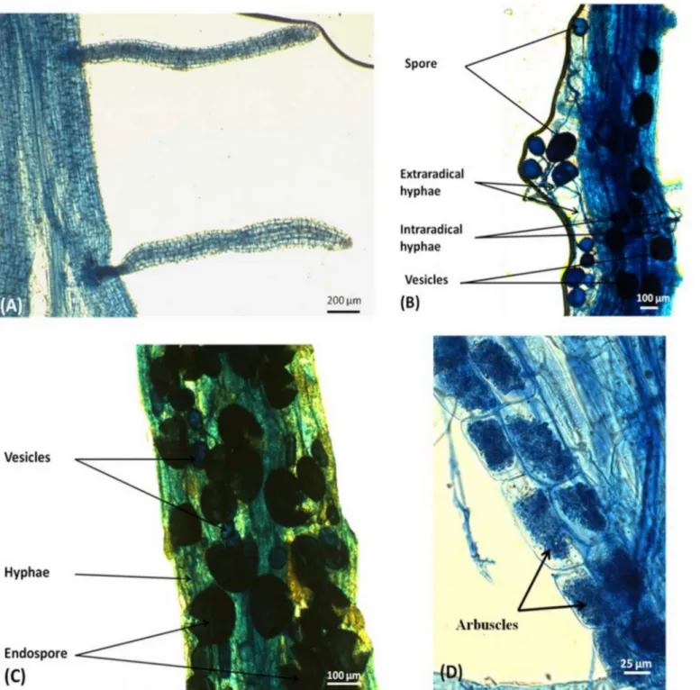 Fig 1. Roots of O. sativa var. Sahel 202 with and without AMF structures. Roots free of AMF structures (A); root fragment colonized by G
