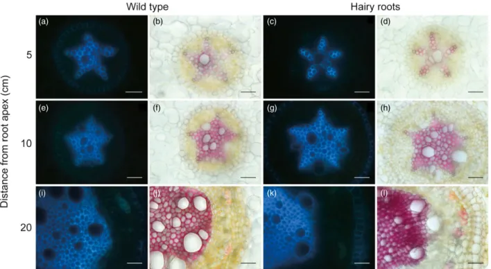 Figure 4 Comparison of xylem development and lignified secondary cell walls between transgenic and wild-type roots