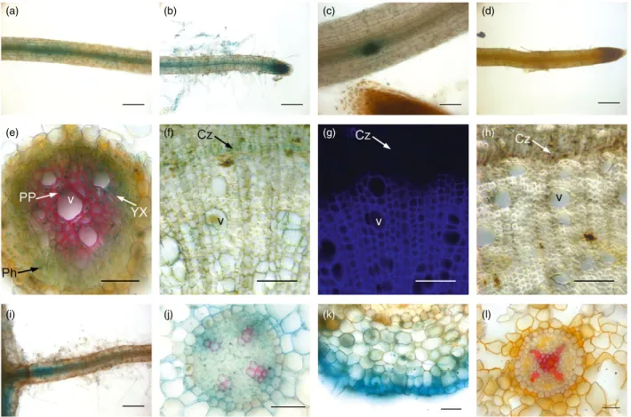 Figure 5 Histochemical localization of GUS activity in Eucalyptus grandis hairy roots transformed with the EgCCR1 and EgCAD2 promoters