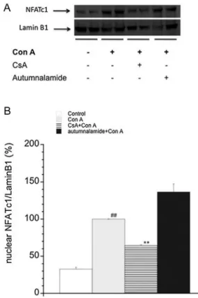 Fig. 8. Effect of autumnalamide or CsA on Ca 2+ /calmodulin-dependent on Phos- Phos-phatase Activity of Calcineurin