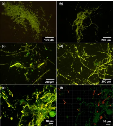 Figure 2. (a–d) Microscopic images of Trichodesmium from LDA and LDB. Observations of poor cell integrity were reported for collected samples, with filaments at various stages of degradation and colony under possible stress