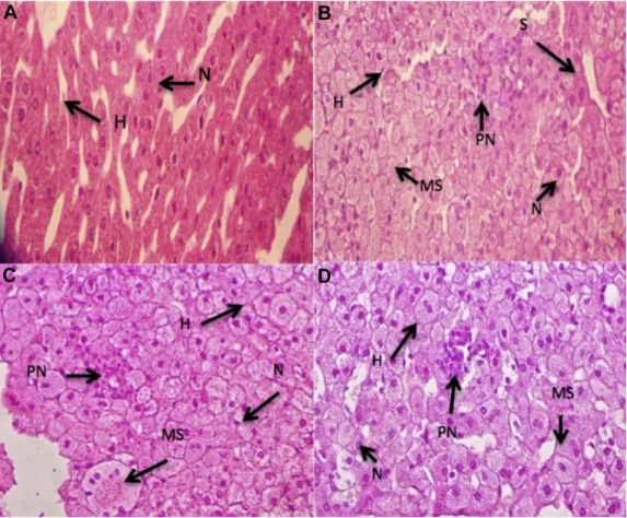 Fig. 1. Histologic evaluation of hepatic steatosis in STD (A), HF (B), HF-SES (C), and HF-Sp (D) groups
