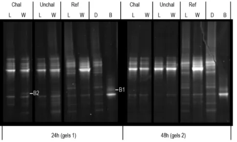 Figure 2. DGGE gels performed with 16 s cDNA extracted from larvae (L) and surrounding water (W)