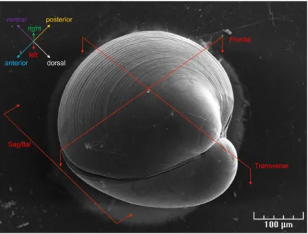Figure 1.  Scanning electron microscopy observation of a settled Crassostrea gigas pediveliger larva