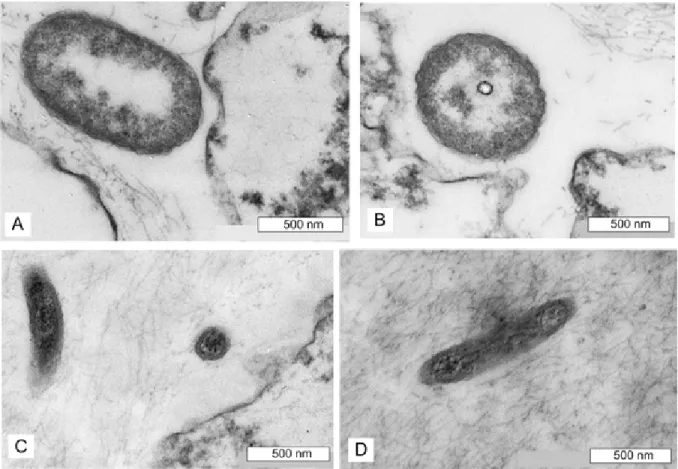 Fig 7. Oscarella carmela TEM of cells. (A) exopinacocyte; (B) endopinacocyte; (C) choanocytes; (D) apopylar cell;