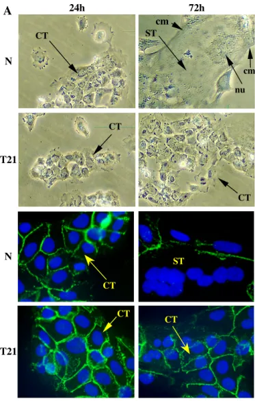 Figure 1 A 24h 72h CT CT CTSTcmNT21 N T21 CT STCTCT cmnu B 72h 1089 ± 61 366 ± 28 ***, p &lt; 0.0001Time ofcultureN (n = 3)T21 (n = 3)24h48h7.4 ± 2.3334 ± 2816.8 ± 9.585 ± 23p = 0.37***, p &lt; 0.0001hCG secretion in mUI/ml/106 cells