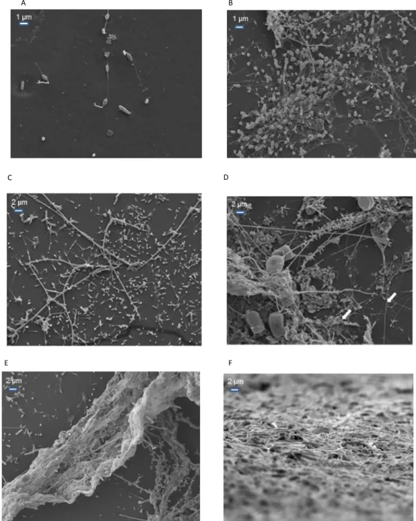 Fig. 5. Scanning electron micrograph photos of bio ﬁ lms for controls (50 larvae mL  1 ) in recycling aquaculture system (RAS) (A and C) and ﬂ ow-through system (FTS) (B and D) on days 7 and 15, respectively, and treatments with 300 larvae mL 1 on day 15 i