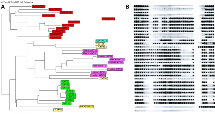 Figure 2. Neighbor-joining (NJ) tree combining of (A) 24-loci MIRU-VNTR and (B) spoligotyping of 34 Mycobacterium tuberculosis strains investigated in French Polynesia