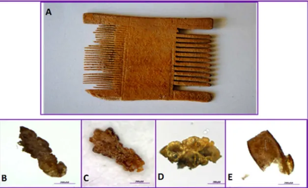 Fig 1. Recovery of ancient human head lice from a two-sided louse comb belonging to the Roman period (A) recovered from the Judean desert and Arava regions of Israel