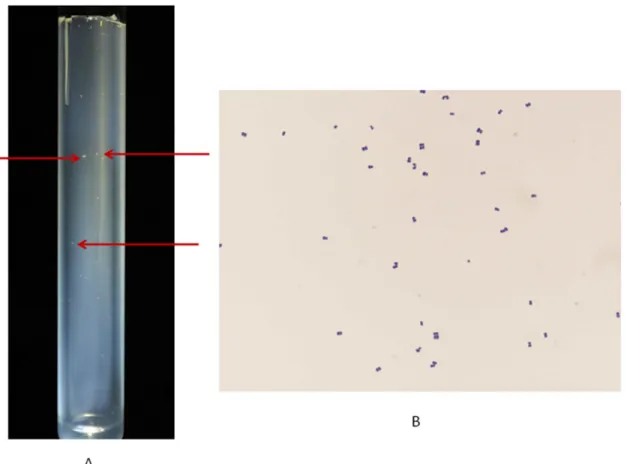 Fig 1. Methanobrevibacter sp. strain N13. (A) Colonies on SAB medium (arrows). (B) Gram-staining.