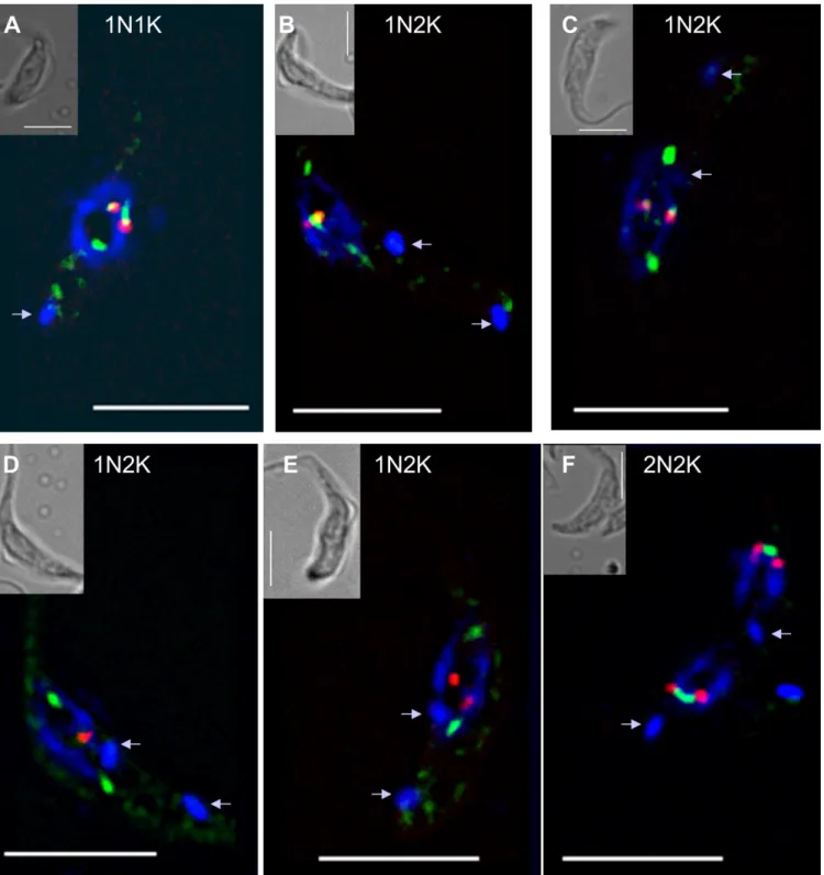 Figure 5. Dynamics of the relocation of TbMlp2 and of the centromeres during the cell cycle progress