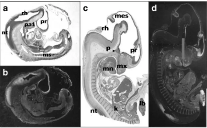 Figure 4 In situ hybridization of GLI3 during human development. (a, b) CS 15; (c, d) CS 19