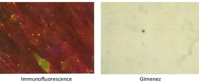 Figure 4. Immunoﬂuorescence in cell culture medium, showing Coxiella burnetii antigen detection, as well as Gimenez staining.