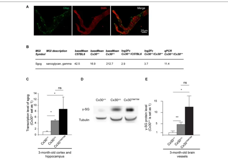 FIGURE 3 | Impairment of Cx30 channels upregulates the expression of γ -Sarcoglycan in brain vessels