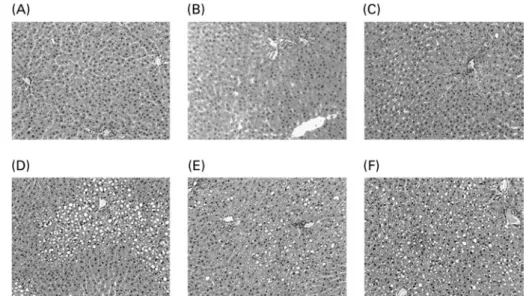 Fig. 1. Liver histology after haematoxylin/eosin staining of liver sections from representative rats of each group: (A) 5 % basal diet; (B) 5 % lard-rich diet;