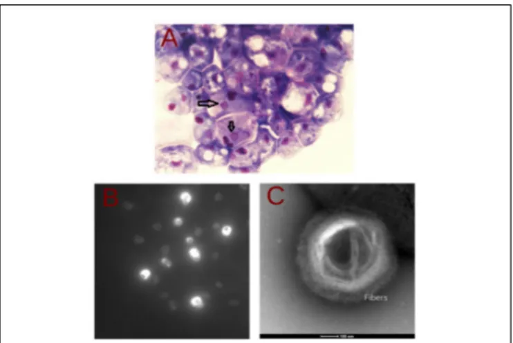 FIGURE 1 | Morphologic analysis of Saudi moumouvirus in Acanthamoeba polyphaga. (A) Inverted microscopic observation of viral infection by hemacolor staining: the nucleus appears as dark purple spots;