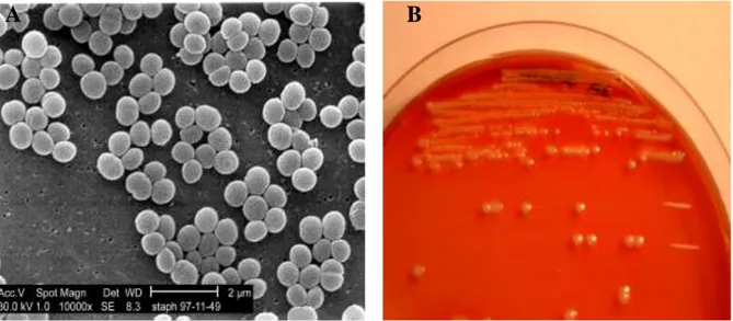 Figure 04 : Aspects microscopique et macroscopique de Staphylococcus aureus (A : S. aureus  en  microscopie  électronique  à  balayage,  B :  Aspect  morphologique  de  S