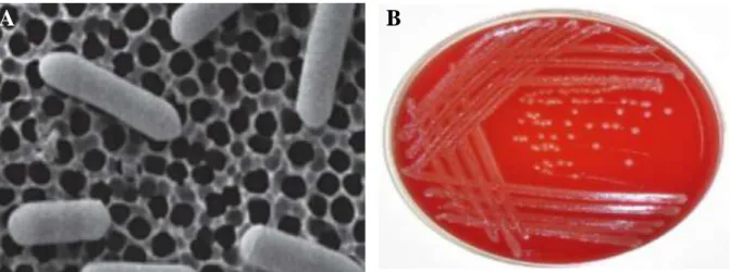 Figure 06  :  Aspects  microscopique  et  macroscopique  de  Listeria  monocytogenes  (A :  L
