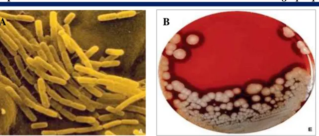Figure 08  :  Aspects  microscopique  et  macroscopique  de  Bacillus  cereus  (A :  B