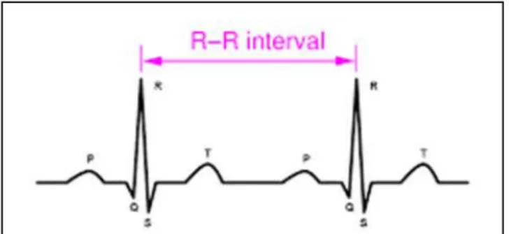 Figure 1.4 : Les intervalles de R-R entre les complexes QRS [23]. 