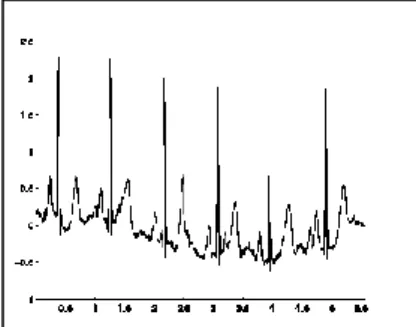 Figure 1.8 : bruits dû aux mouvements des électrodes  [18]. 