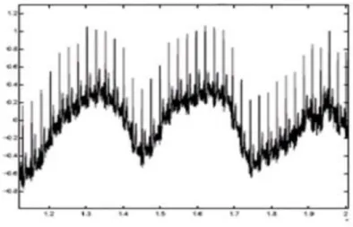 Figure 2.3 : dérive de la ligne de base 