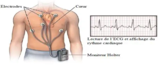 Figure I.12. Enregistreur Holter numérique [28]. 