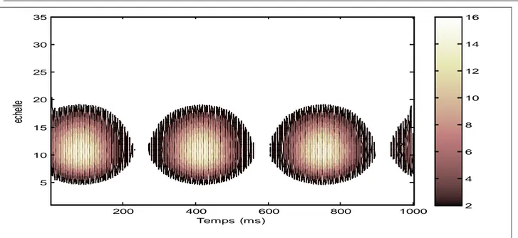 Fig. 2.2 : Signal modulé en amplitude: (a) Représentation temporelle, (b) Spectre de fréquence (c)  Scalogramme avec l’ondelette de Symlet, (d) Scalogramme obtenu avec l’ondelette de Daubechies 