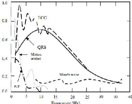 Figure 3. 10.Densité spectrale de puissance de L'ECG et de ses composantes [23].