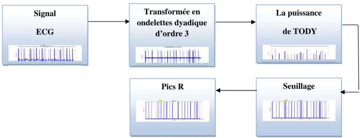 Figure 3. 11.Schéma bloc de la détection du complexe QRS.