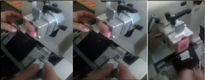 Figure 17: Realization of histological sections using a microtome  II-5-5-Attaching the cut to the blade 