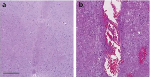 Fig. 4 H&amp;E histology of brain tissue after probe insertion at the injection sites of (a) the 350-μm-diameter probe and (b) the 1250-μm probe