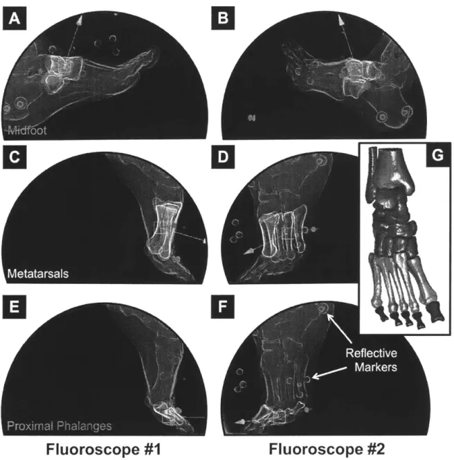 Figure  3-4:  Bone  Motion  Tracking  using  Autoscoper  - Three-dimensional  bone volumes  (displayed  on  radiographs  in  semi-transparent  yellow)  are  overlaid  with BiFlo  radiographs  (blue  background  images)  in  images  A-F