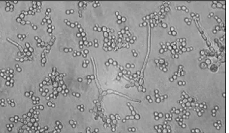 Figure 11. Dimorphisme chez C. albicans : la micrographie montre un mélange de  levures, de cellules bourgeonnantes et de formes hyphes (Walker, 2009)